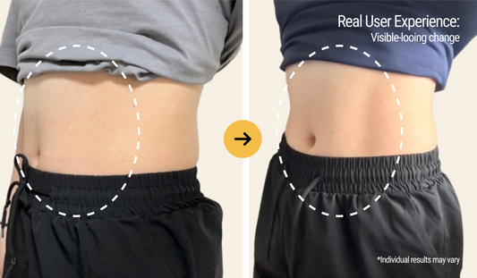 Cellulite or Loose Skin? How to Tell the Difference and Care for Both